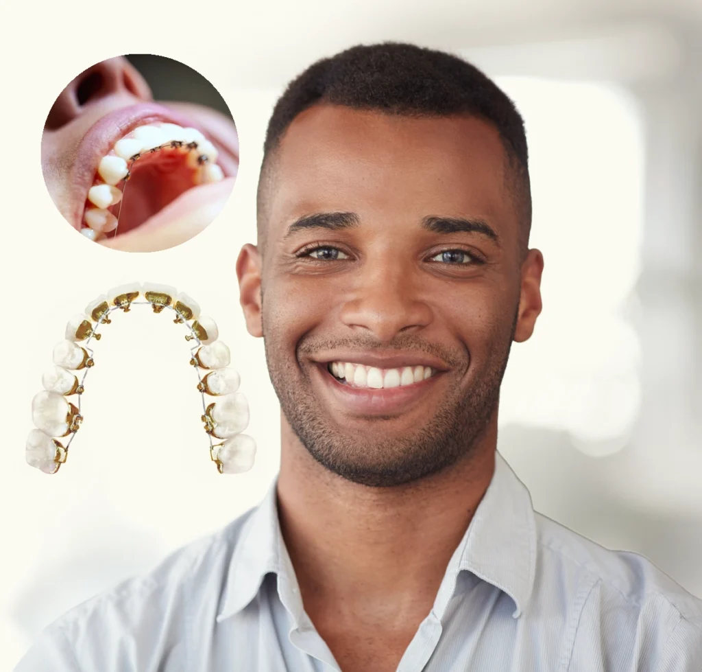 5 Signs You or Your Child Might Need Braces